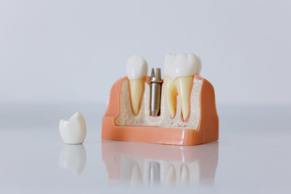 Dental Implants Vs Dentures