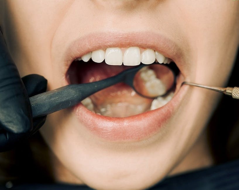 Senior Dental Care: Common Dental Issues And Solutions