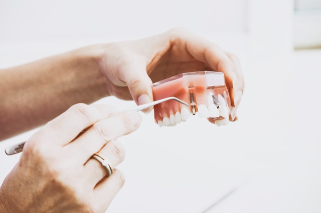 Golden Smiles How Senior Dental Health Impacts Longevity.
