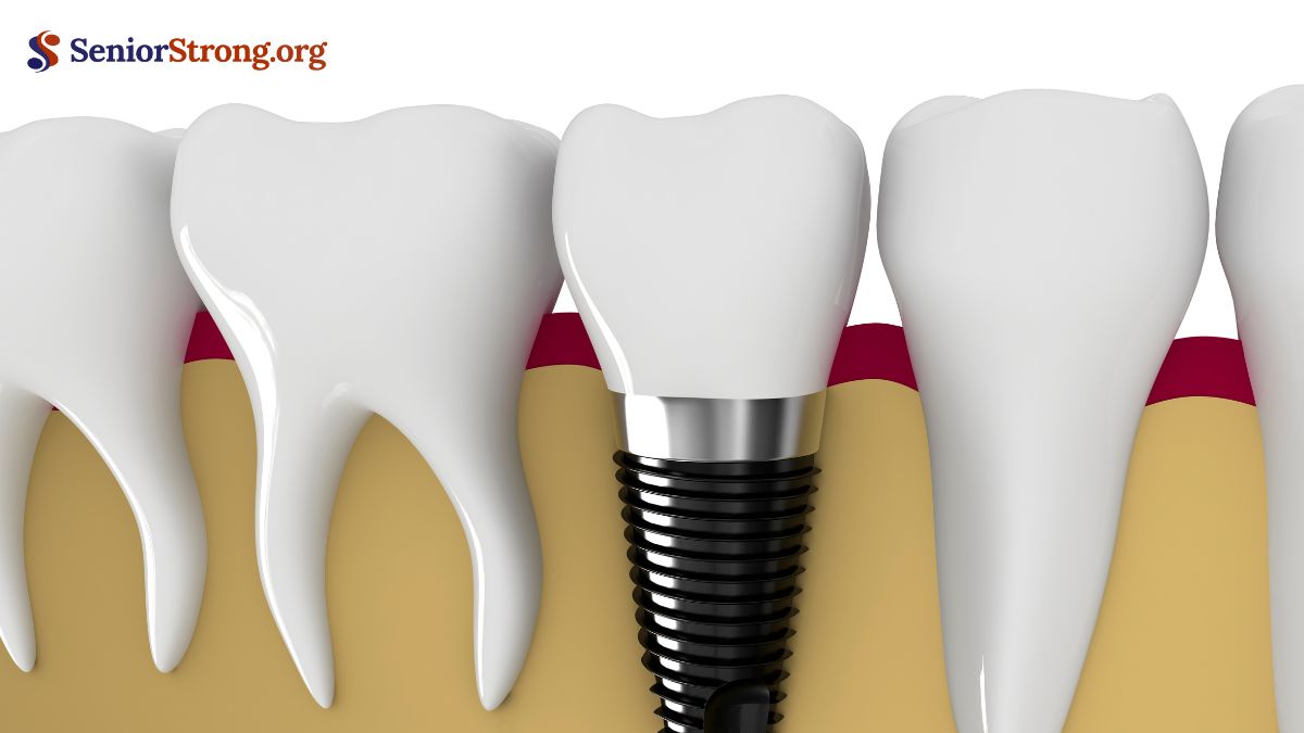 Alternatives to Implants