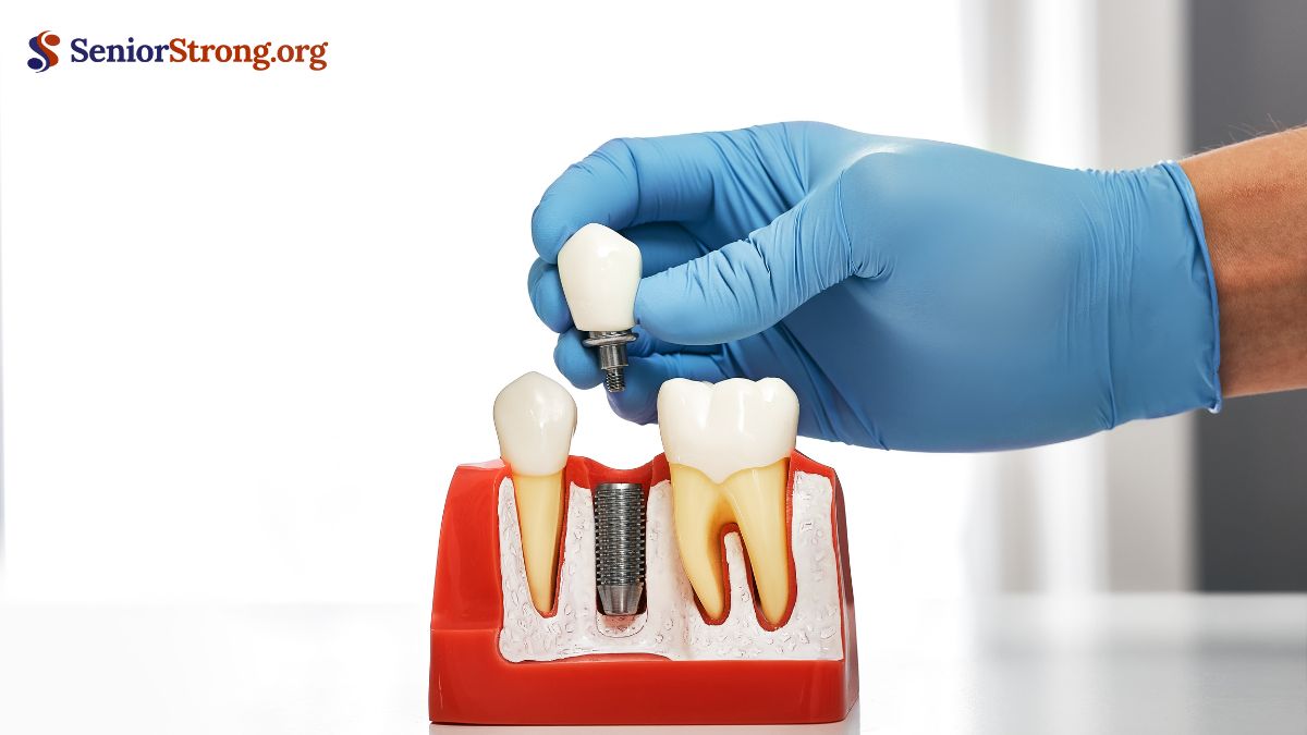 Benefits of Dental Implants