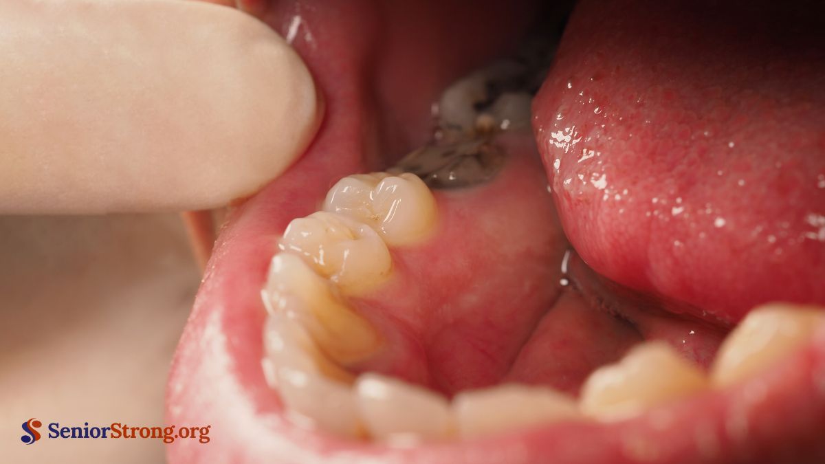 Common Oral Health Problems