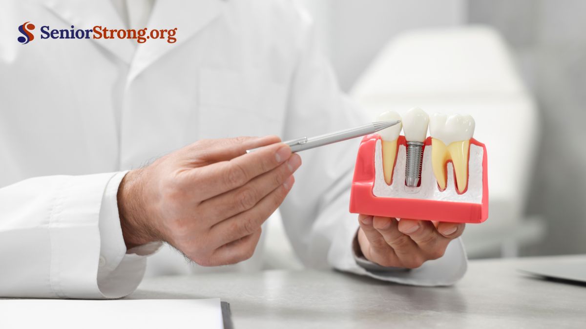Cost Considerations for Implants
