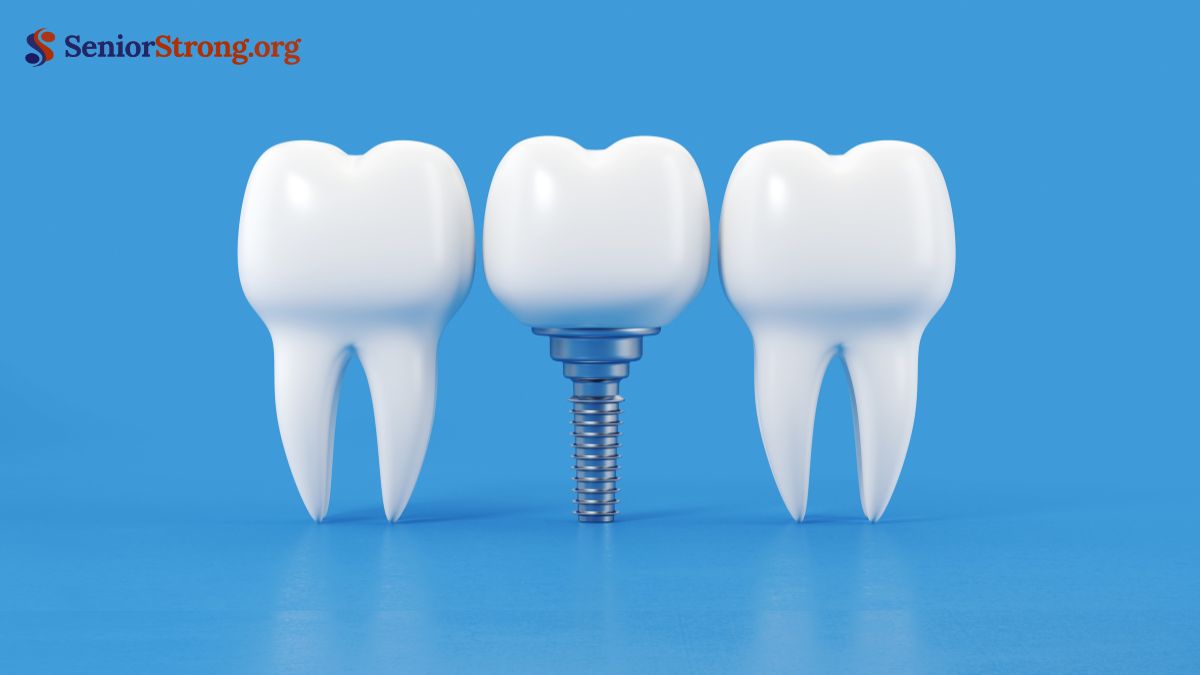 Implants for Seniors A Comprehensive Guide